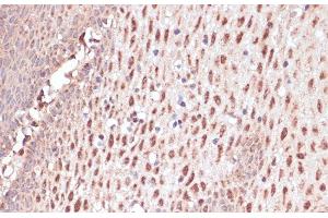 Immunohistochemistry of paraffin-embedded Human esophageal using RAD50 Polyclonal Antibody at dilution of 1:100 (40x lens).
