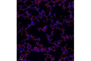 Immunofluorescence of paraffin embedded mouse lung using MRP1 (ABIN7074544) at dilution of 1:1000 (250x lens) (Multidrug-Resistance Like Protein 1 anticorps)