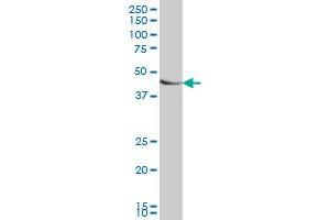 SMAD7 monoclonal antibody (M06), clone 4E1 Western Blot analysis of SMAD7 expression in HeLa . (SMAD7 anticorps  (AA 160-260))