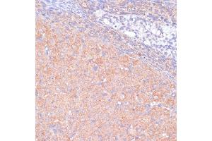 Immunohistochemistry of paraffin-embedded rat ovary using K antibody (ABIN7268147) at dilution of 1:100 (40x lens). (KANK2 anticorps  (AA 1-300))