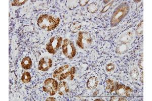 Immunoperoxidase of monoclonal antibody to TLN1 on formalin-fixed paraffin-embedded human stomach. (TLN1 anticorps  (AA 1052-1149))