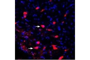 Expression of KCNK2 (TREK-1) in rat midbrain - Immunohistochemical staining of perfusion-fixed frozen rat brain sections using Guinea pig Anti-KCNK2 (TREK-1) Antibody (ABIN7043451, ABIN7045404 and ABIN7045405), (1:400), followed by goat-anti-guinea pig-Cy3 antibody.