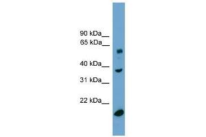 TBL1Y antibody used at 0. (TBL1Y anticorps  (Middle Region))