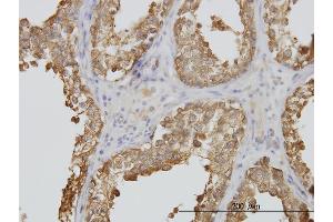 Immunoperoxidase of monoclonal antibody to TUBA2 on formalin-fixed paraffin-embedded human testis.