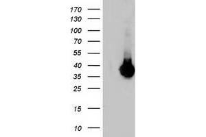 Western Blotting (WB) image for anti-Low Density Lipoprotein Receptor Adaptor Protein 1 (LDLRAP1) antibody (ABIN1496688) (LDLRAP1 anticorps)