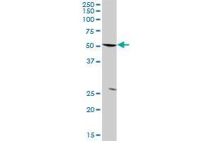 PFKFB3 MaxPab rabbit polyclonal antibody. (PFKFB3 anticorps  (AA 1-520))