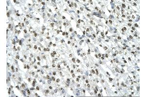 Rabbit Anti-HMGB2 antibody   Paraffin Embedded Tissue: Human Heart cell Cellular Data: cardiac cell of renal tubule Antibody Concentration: 4. (HMGB2 anticorps  (C-Term))