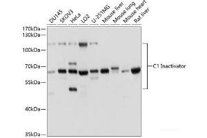 Western blot analysis of extracts of various cell lines using C1 Inactivator Polyclonal Antibody at dilution of 1:1000. (SERPING1 anticorps)