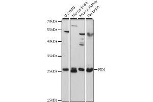 Western blot analysis of extracts of various cell lines, using PID1 antibody (ABIN6133302, ABIN6145610, ABIN6145611 and ABIN6217139) at 1:3000 dilution. (PID1 anticorps  (AA 124-248))