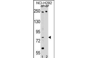 Western blot analysis of PL2 Antibody (N-term) Pab 17460a pre-incubated without(lane 1) and with(lane 2) blocking peptide in NCI- cell line lysate. (APPL2 anticorps  (N-Term))