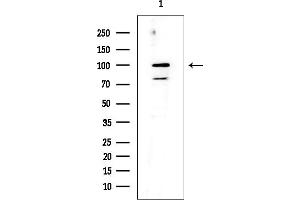 Western blot analysis of lysates from HUVEC cells, using DNMT3B Mouse Monoclonal Antibody at 1/1000 dilution.