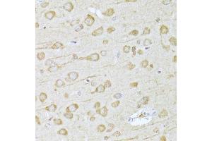Immunohistochemistry of paraffin-embedded rat brain using FDPS Antibody.