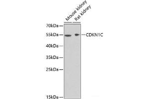 Western blot analysis of extracts of various cell lines using CDKN1C Polyclonal Antibody at dilution of 1:1000. (CDKN1C anticorps)