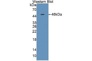 Detection of Recombinant TNNC1, Human using Polyclonal Antibody to Troponin C Type 1, Slow (TNNC1)