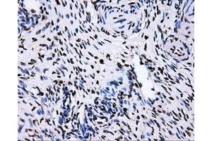 Immunohistochemical staining of paraffin-embedded Ovary tissue using anti-RALBP1mouse monoclonal antibody. (RALBP1 anticorps)