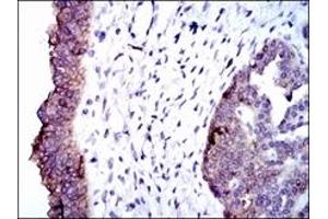 Immunohistochemistry (IHC) image for anti-Alkaline Phosphatase, Liver/bone/kidney (ALPL) antibody (ABIN1105293)