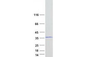 Validation with Western Blot