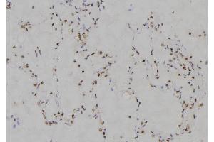 ABIN6274221 at 1/100 staining Human lung tissue by IHC-P. (MZF1 anticorps  (N-Term))