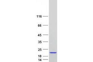 Validation with Western Blot