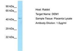 Image no. 1 for anti-Exonuclease 5 (EXO5) (AA 202-251) antibody (ABIN6750050) (EXO5 anticorps  (AA 202-251))