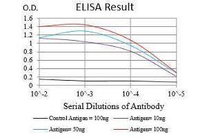 Black line: Control Antigen (100 ng), Purple line: Antigen(10 ng), Blue line: Antigen (50 ng), Red line: Antigen (100 ng), (ZEB1 anticorps  (AA 967-1108))