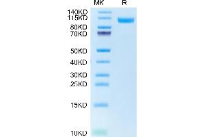 Human NCAM-1 on Tris-Bis PAGE under reduced condition.