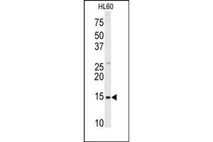 Image no. 1 for anti-SnRNP-D1 / Sm-D (Middle Region) antibody (ABIN358018) (SnRNP-D1 / Sm-D (Middle Region) anticorps)