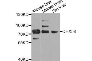 Western blot analysis of extracts of various cell lines, using DHX58 antibody (ABIN5974537) at 1/1000 dilution. (DHX58 anticorps)