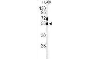 Western Blotting (WB) image for anti-Guanine Deaminase (GDA) antibody (ABIN3004286)