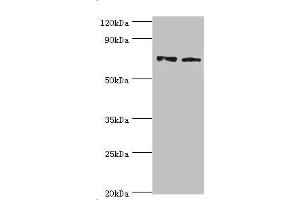 Western blot All lanes: Annexin A6 antibody at 4 μg/mL Lane 1: Jurkat whole cell lysate Lane 2: Hela whole cell lysate Secondary Goat polyclonal to rabbit IgG at 1/10000 dilution Predicted band size: 76, 73 kDa Observed band size: 76 kDa (ANXA6 anticorps  (AA 1-250))