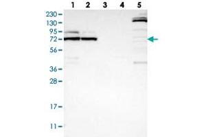 Western blot analysis of Lane 1: RT-4, Lane 2: U-251 MG, Lane 3: Human Plasma, Lane 4: Liver, Lane 5: Tonsil with METTL16 polyclonal antibody  at 1:250-1:500 dilution. (METTL16 anticorps)