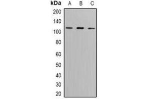 Western blot analysis of GLUR6 expression in SW620 (A), A549 (B), mouse brain (C) whole cell lysates. (GRIK2 anticorps)