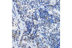 Immunohistochemistry of paraffin-embedded rat spleen using MYBBP1A Rabbit pAb (ABIN1680938, ABIN3018915, ABIN3018916 and ABIN6220628) at dilution of 1:100 (40x lens). (MYBBP1A anticorps  (AA 1104-1328))