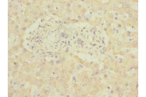 Immunohistochemistry of paraffin-embedded human liver tissue using ABIN7143403 at dilution of 1:100 (ADGRG6 (AA 40-300) anticorps)