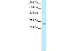 WB Suggested Anti-RGS16 Antibody Titration:  1. (RGS16 anticorps  (C-Term))