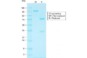 SDS-PAGE Analysis Purified EpCAM Rabbit Recombinant Monoclonal Antibody (EGP40/1556R). (Recombinant EpCAM anticorps)