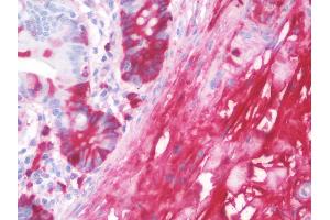 Anti-VTN / Vitronectin antibody IHC staining of human small intestine.