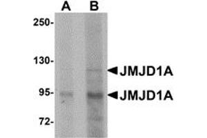 Western Blotting (WB) image for anti-Lysine (K)-Specific Demethylase 3A (KDM3A) (N-Term) antibody (ABIN1031423) (KDM3A anticorps  (N-Term))