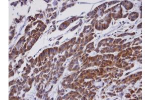 IHC-P Image Immunohistochemical analysis of paraffin-embedded A549 xenograft, using ORP1, antibody at 1:100 dilution. (OSBPL1A anticorps  (C-Term))