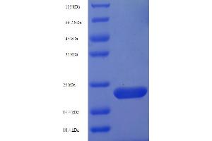 SDS-PAGE (SDS) image for Aquaporin 4 (AQP4) (AA 253-323) protein (His-SUMO Tag) (ABIN5709073)