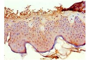 Immunohistochemistry of paraffin-embedded human skin tissue using ABIN7167500 at dilution of 1:100