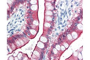 Anti-VIL1 / Villin antibody IHC of human small intestine.