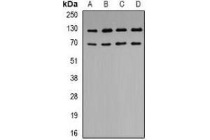 Western blot analysis of K Cadherin expression in BT474 (A), A549 (B), SHSY5Y (C), HEK293T (D) whole cell lysates. (CDH6 anticorps)