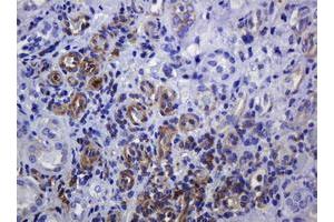Immunohistochemistry (IHC) image for anti-Sterol O-Acyltransferase 2 (SOAT2) (AA 1-120) antibody (ABIN1490565)