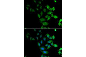 Immunofluorescence analysis of U2OS cells using PSG1 antibody (ABIN6293474). (PSG1 anticorps)