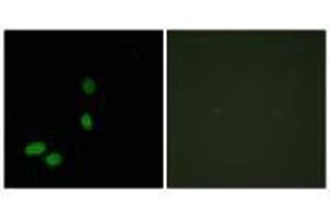 Immunofluorescence analysis of HeLa cells, using HMG17 antibody.