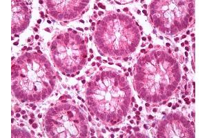 Anti-FAK antibody IHC of human colon, lymphocytes.