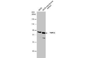 WB Image A549 whole cell and membrane extracts (30 μg) were separated by 7.
