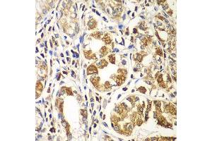 Immunohistochemistry of paraffin-embedded human gastric using RAC1 antibody.