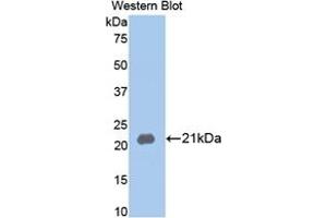 WB of Protein Standard: different control antibodies against Highly purified E.
